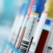 Banner Health reaches capacity on ECMO lung machines