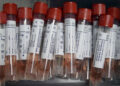 Pooled Testing For Coronavirus Gets Another Look : Shots