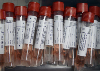 Pooled Testing For Coronavirus Gets Another Look : Shots