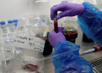 UK Pauses Daily Coronavirus Death Toll Update Over Data Concerns | World News