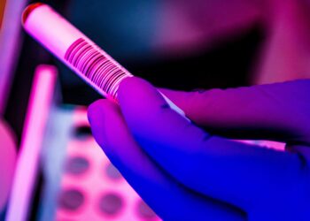 States seek faster COVID test results