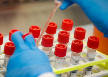 Austin Public Health: No need for employees to provide multiple negative tests