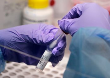 Coronavirus live updates: CDC says not all close contacts need to get tested after exposure, alarming experts