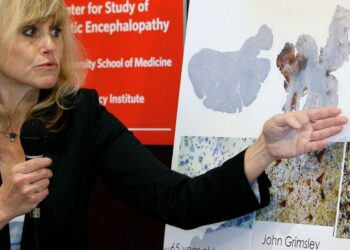 Hospitalized patients prone to brain malfunction, study finds