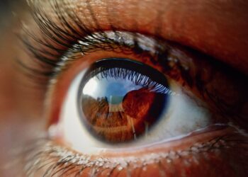 The Eyes Are Windows into Sport-Related Concussion in Adolescents