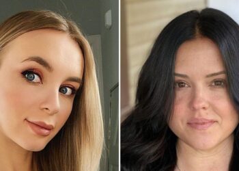 Yara, More Talk Plastic Surgery